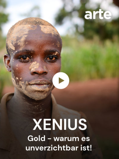 ARTE Xenius Gold-warum es unverzichtbar ist